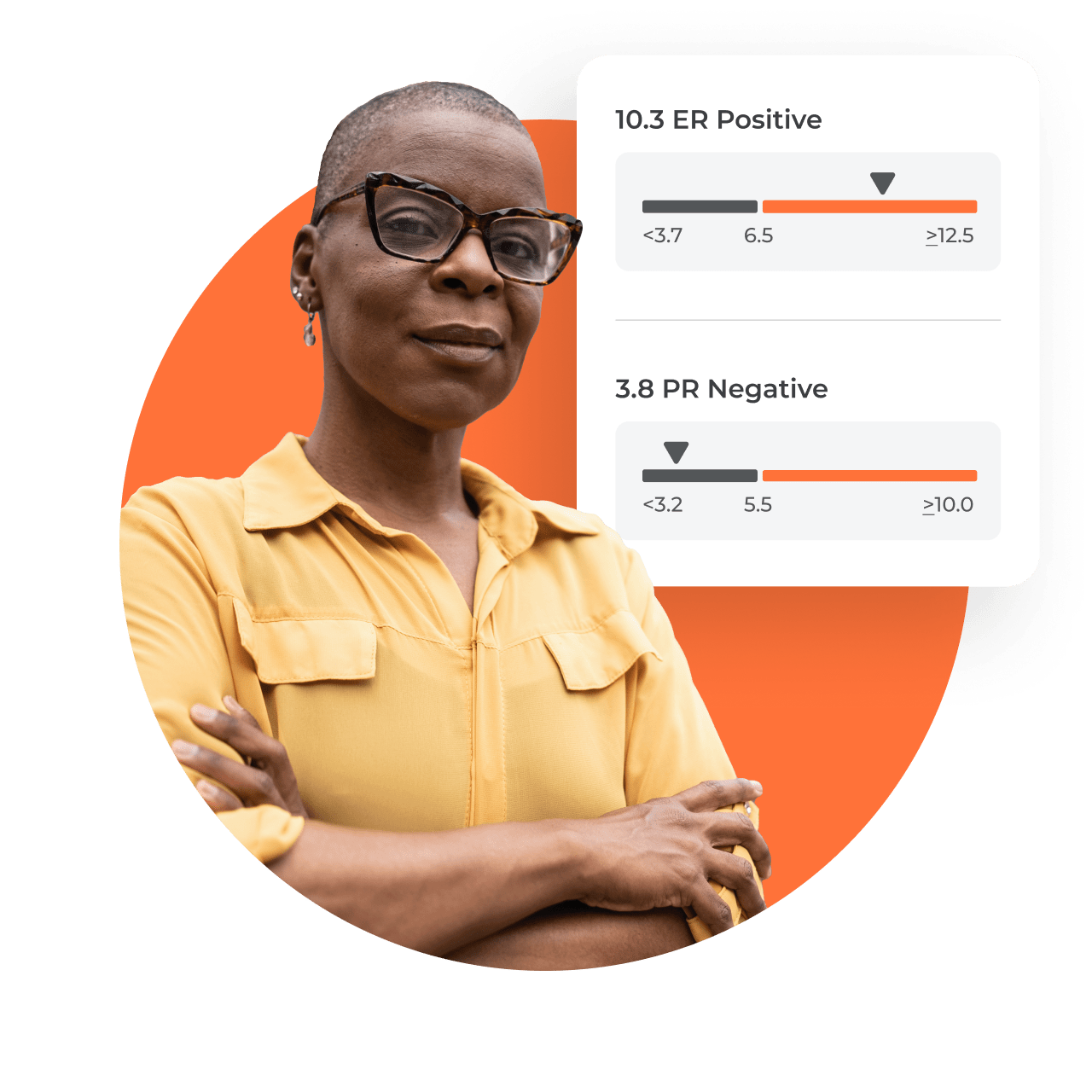 Oncotype DX Breast Recurrence Score® Test | Exact Sciences